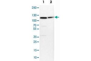 Western Blot analysis of Lane 1: NIH-3T3 cell lysate (mouse embryonic fibroblast cells) and Lane 2: NBT-II cell lysate (Wistar rat bladder tumor cells) with MCM6 polyclonal antibody . (MCM6 Antikörper)