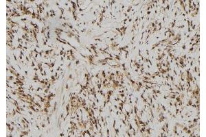 ABIN6279761 at 1/100 staining Human gastric tissue by IHC-P. (RFPL2 Antikörper)