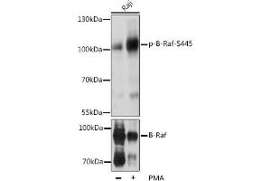 Western blot analysis of extracts of Raji cells, using Phospho-B-Raf-S445 pAb (ABIN3019431, ABIN3019432, ABIN3019433, ABIN1681422 and ABIN6225367) at 1:2000 dilution or BRAF antibody (ABIN6131244, ABIN6137637, ABIN6137639 and ABIN6213593). (BRAF Antikörper  (pSer445))