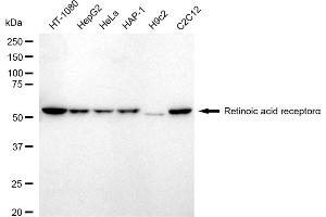 Western blotting analysis using Retinoic acid receptor alpha antibody (ABIN7800189).