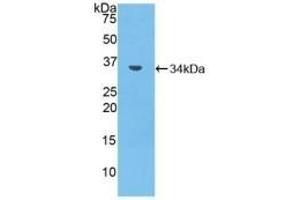 Detection of Recombinant MMP7, Mouse using Polyclonal Antibody to Matrix Metalloproteinase 7 (MMP7) (MMP7 Antikörper  (AA 1-264))