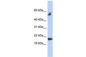 Image no. 1 for anti-Testis Expressed 19 (TEX19) (C-Term) antibody (ABIN6743950)