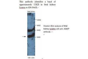 Image no. 1 for anti-Angio-Associated, Migratory Cell Protein (AAMP) antibody (ABIN790850) (AAMP Antikörper)