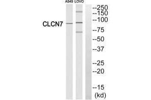 Western blot analysis of extracts from A549 cells and LOVO cells, using CLCN7 antibody. (CLCN7 Antikörper  (N-Term))