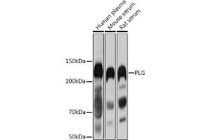 Western blot analysis of extracts of various cell lines, using PLG antibody (ABIN1682202, ABIN3017690, ABIN3017692 and ABIN6220212) at 1:1000 dilution. (PLG Antikörper  (AA 20-300))
