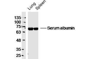 Lane 1: Mouse Lung lysates Lane 2: Mouse Spleen lysates probed with Serum albumin Polyclonal Antibody, Unconjugated  at 1:300 dilution and 4˚C overnight incubation. (Albumin Antikörper)