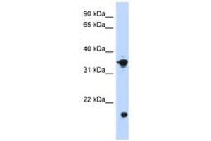 Image no. 1 for anti-Glycerol-3-Phosphate Dehydrogenase 1 (Soluble) (GPD1) (AA 251-300) antibody (ABIN6740752) (GPD1 Antikörper  (AA 251-300))