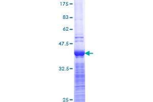 Image no. 1 for ATP-Binding Cassette, Sub-Family C (CFTR/MRP), Member 2 (ABCC2) (AA 214-313) protein (GST tag) (ABIN1305455) (ABCC2 Protein (AA 214-313) (GST tag))