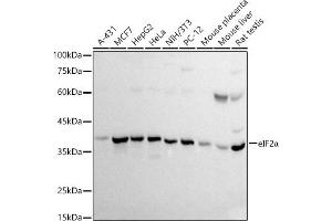 Western blot analysis of extracts of various cell lines, using eIF2α antibody (ABIN3021126, ABIN3021127, ABIN5663762 and ABIN6213983) at 1:500 dilution. (EIF2S1 Antikörper  (AA 1-260))