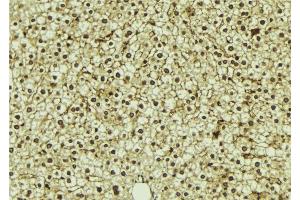 ABIN6273311 at 1/100 staining Mouse liver tissue by IHC-P.