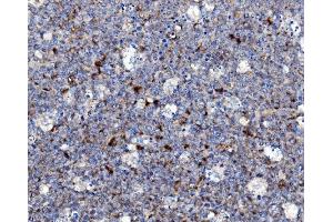 IHC analysis of NOXA2/p67phox/NCF2 using anti-NOXA2/p67phox/NCF2 antibody (ABIN7599462). (NCF2 Antikörper  (AA 1-526))