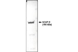 Western Blotting (WB) image for anti-Structural Maintenance of Chromosomes 2 (SMC2) (AA 523-768) antibody (ABIN264446) (SMC2 Antikörper  (AA 523-768))