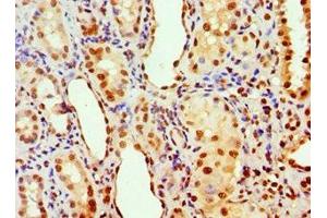 Immunohistochemistry (IHC) image for anti-Acidic (Leucine-Rich) Nuclear phosphoprotein 32 Family, Member A (ANP32A) (AA 1-170) antibody (ABIN7143011)