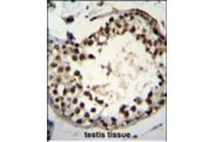 Immunohistochemistry analysis in formalin fixed and paraffin embedded human testis tissue using ASXL1 Antibody followed by peroxidase conjugation of the secondary antibody and DAB staining.