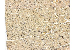 ABIN7096031 and ABIN7100093 at 1/100 staining mouse liver tissue by IHC-P. (DENND1A Antikörper)