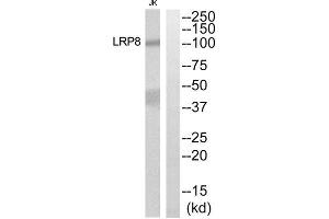 Western blot analysis of extracts from Jurkat cells, using LRP8 antibody.