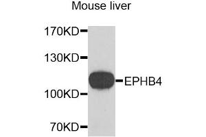 Western blot analysis of extracts of mouse liver, using EPHB4 antibody. (EPH Receptor B4 Antikörper)