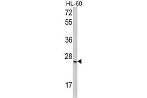 Western blot analysis of SFRS1 Antibody (C-term) in HL-60 cell line lysates (35ug/lane). (SRSF1 Antikörper  (C-Term))