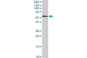 STK3 monoclonal antibody (M13), clone 4F7. (STK3 Antikörper  (AA 311-431))