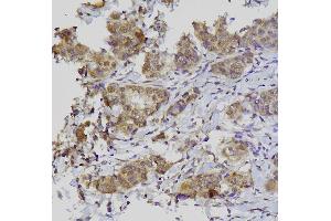 IHC analysis of GATA3 using anti-GATA3 antibody (ABIN7603171).