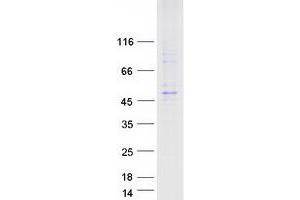 Western Blotting (WB) image for Limb Region 1 Homolog (LMBR1) protein (Myc-DYKDDDDK Tag) (ABIN2724849)