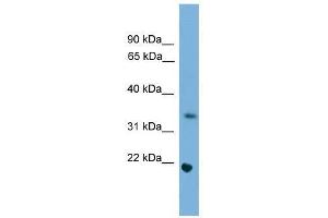Western Blot showing Sohlh1 antibody used at a concentration of 1-2 ug/ml to detect its target protein. (SOHLH1 Antikörper  (Middle Region))