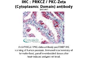Image no. 1 for anti-Protein Kinase C, zeta (PRKCZ) (1st Cytoplasmic Domain) antibody (ABIN1738343) (PKC zeta Antikörper  (1st Cytoplasmic Domain))