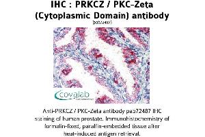 Image no. 1 for anti-Protein Kinase C, zeta (PRKCZ) (1st Cytoplasmic Domain) antibody (ABIN1738343)