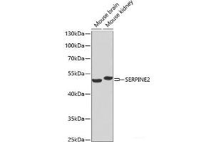 Western blot analysis of extracts of various cell lines using SERPINE2 Polyclonal Antibody at dilution of 1:1000. (SERPINE2 Antikörper)