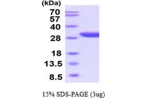 SDS-PAGE (SDS) image for Erythropoietin Receptor (EPOR) (AA 25-250) (Active) protein (His tag) (ABIN6387943)