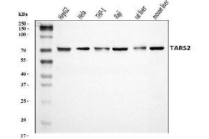 Western blot analysis of TARS2 using anti-TARS2 antibody (ABIN7602308).