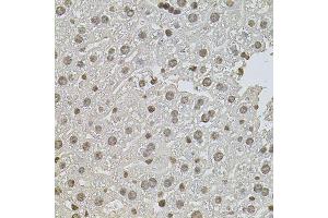 Immunohistochemistry of paraffin-embedded mouse liver using ZNF408 antibody (ABIN5974874) at dilution of 1/100 (40x lens). (ZNF408 Antikörper)