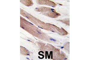 Formalin-fixed and paraffin-embedded human skeletal muscle tissue reacted with PIK3R1 polyclonal antibody  , which was peroxidase-conjugated to the secondary antibody, followed by DAB staining. (PIK3R1 Antikörper  (Tyr580))