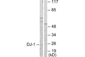 Western blot analysis of extracts from HuvEc cells, using DJ-1 antibody (ABIN5976380). (PARK7/DJ1 Antikörper  (Internal Region))