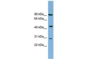 Image no. 1 for anti-Nitrogen Permease Regulator-Like 2 (S. Cerevisiae) (NPRL2) (AA 287-336) antibody (ABIN6742041) (NPRL2 Antikörper  (AA 287-336))