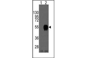 Western blot analysis of CD14(arrow) using rabbit polyclonal CD14 Antibody (CD14 Antikörper  (N-Term))