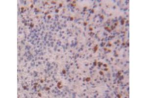 Used in DAB staining on fromalin fixed paraffin- embedded Kidney tissue (NCF4 Antikörper  (AA 132-339))