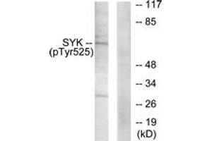 Western blot analysis of extracts from A549 cells, using SYK (Phospho-Tyr525) Antibody. (SYK Antikörper  (pTyr525))
