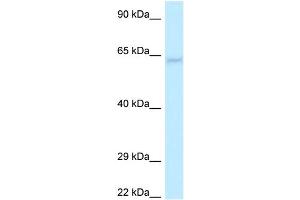 WB Suggested Anti-LGI1 Antibody Titration: 1. (LGI1 Antikörper  (N-Term))