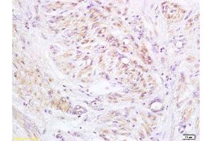 Immunohistochemistry (Paraffin-embedded Sections) (IHC (p)) image for anti-ATP-Binding Cassette, Sub-Family D (Ald), Member 3 (ABCD3) (AA 51-160) antibody (ABIN1386868)