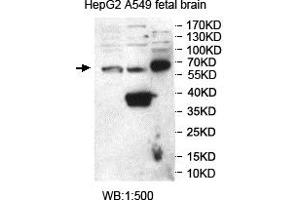 Western blot analysis of HepG2, A549 and fetal brain lysates, using SNTG2 antibody. (SNTG2 Antikörper  (AA 143-324))