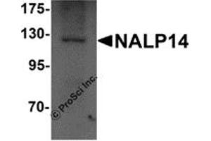 Western Blotting (WB) image for anti-NLR Family, Pyrin Domain Containing 14 (NLRP14) (N-Term) antibody (ABIN1031469)