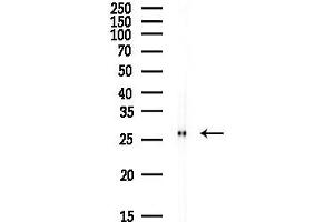 anti-Carbonic Anhydrase II (CA2) (C-Term) antibody