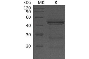 Western Blotting (WB) image for Interleukin 12 (IL12) protein (ABIN7320573) (IL12 Protein)