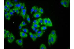 Immunofluorescence staining of HepG2 cells with ABIN7167509 at 1:133, counter-stained with DAPI. (PTPRK Antikörper  (AA 589-749))