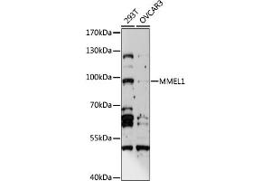 Western blot analysis of extracts of various cell lines, using MMEL1 antibody (ABIN6293386) at 1:1000 dilution. (MMEL1 Antikörper)
