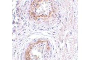Immunohistochemistry of TEM5 in human bladder tissue with this product at 5 μg/ml. (GPR124 Antikörper  (C-Term))