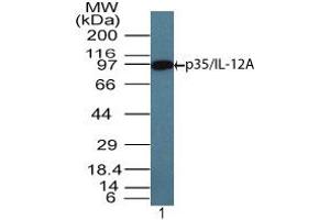 Image no. 1 for anti-Interleukin 12 alpha (IL12A) (AA 200-250) antibody (ABIN960224) (IL12A Antikörper  (AA 200-250))