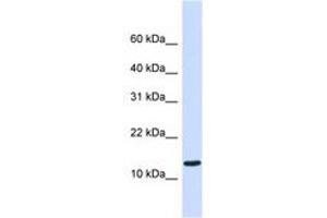 Image no. 1 for anti-Chromosome 1 Open Reading Frame 95 (C1ORF95) (C-Term) antibody (ABIN6740873) (C1ORF95 Antikörper  (C-Term))