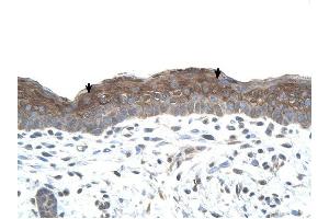 LOC400856 antibody was used for immunohistochemistry at a concentration of 4-8 ug/ml to stain Squamous epithelial cells (arrows) in Human Skin. (LOC400856 Antikörper  (C-Term))